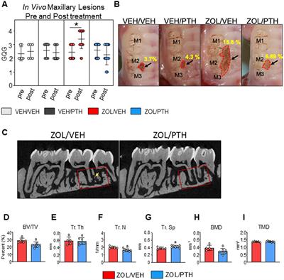 Intermittent parathyroid hormone enhances the healing of medication-related osteonecrosis of the jaw lesions in rice rats